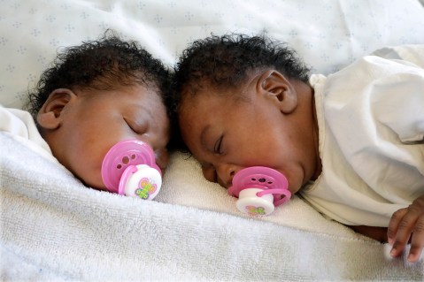 Miracle medical team separates twins joined at the head