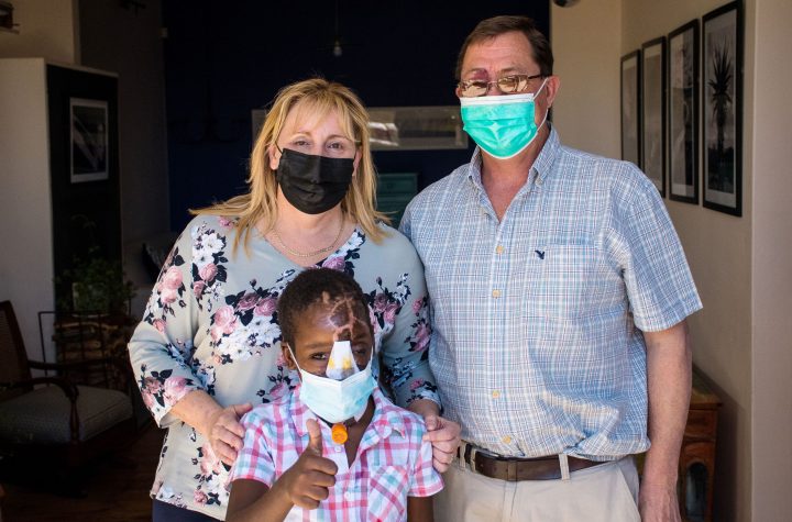 What we learn from each other: Zimbabwean boy mauled by hyena given prosthetic nose and eye