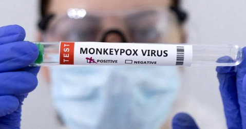 Monkeypox – experts answer 10 common questions