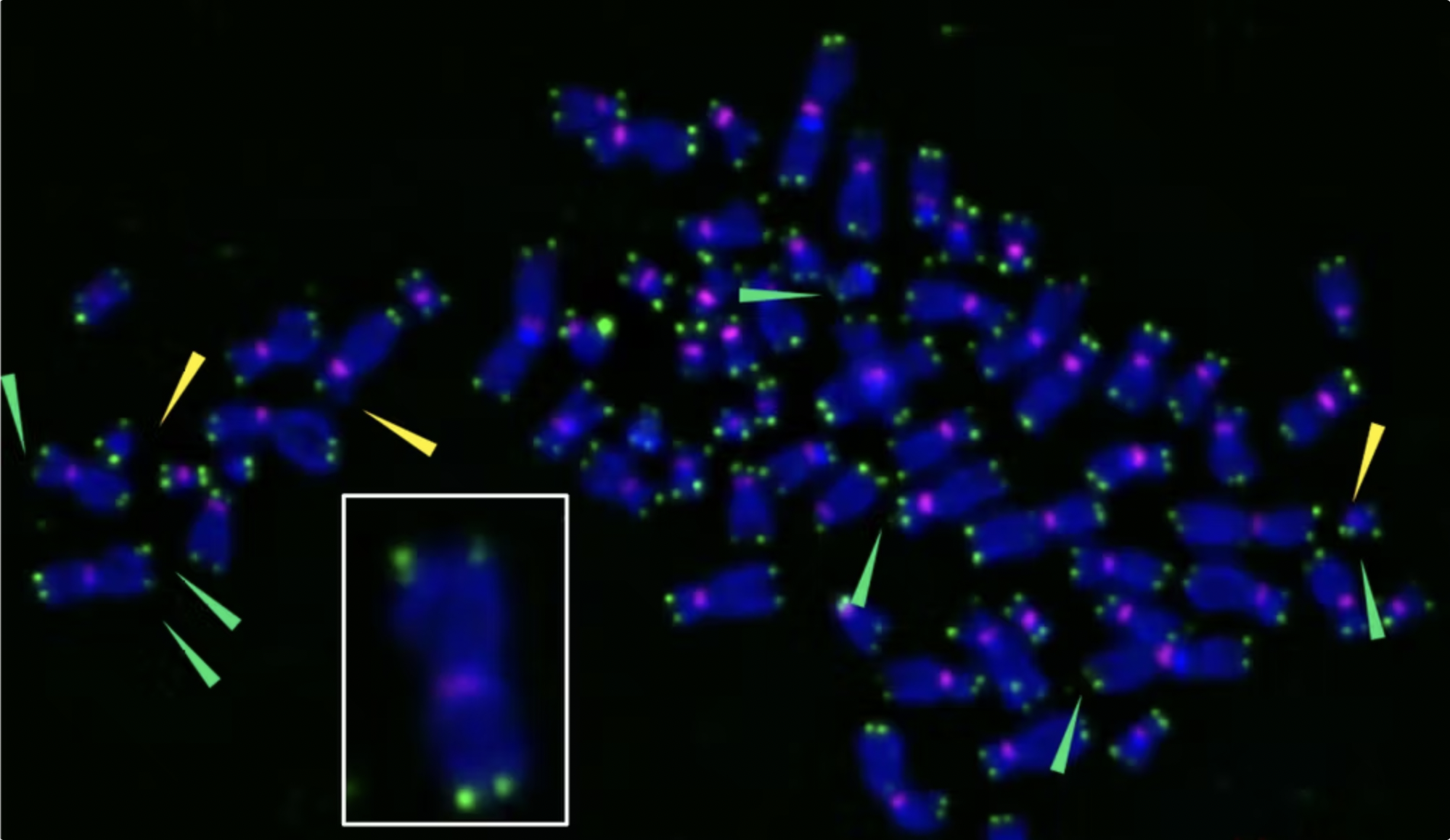 The telomeres (green) at the tips of chromosomes (blue) damaged by free radicals become fragile (green arrows) and trigger senescence.