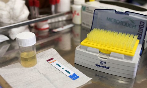After slow start, uptake for urine TB test is picking up