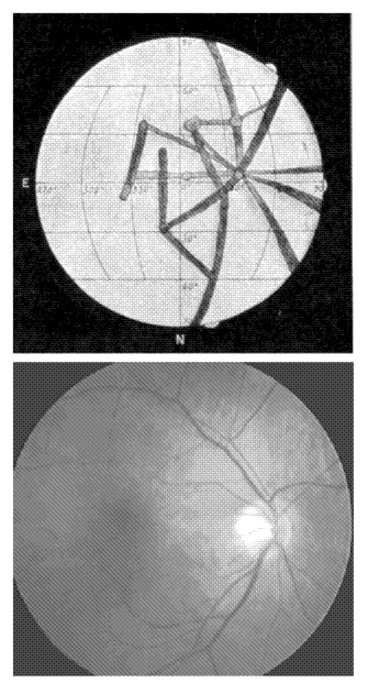 Lowell's chart of the spokes of Venus and an opthalmoscope photograph of the blood vessels diverging from the optic cup. Image: NASA Astrophysics Data System