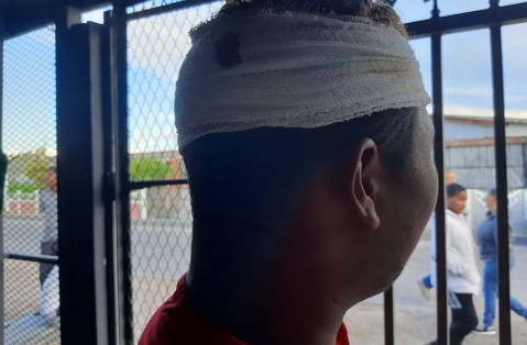 Cape Town learner attacked with ‘brick, knuckle dusters and a piece of wood’ by fellow pupils