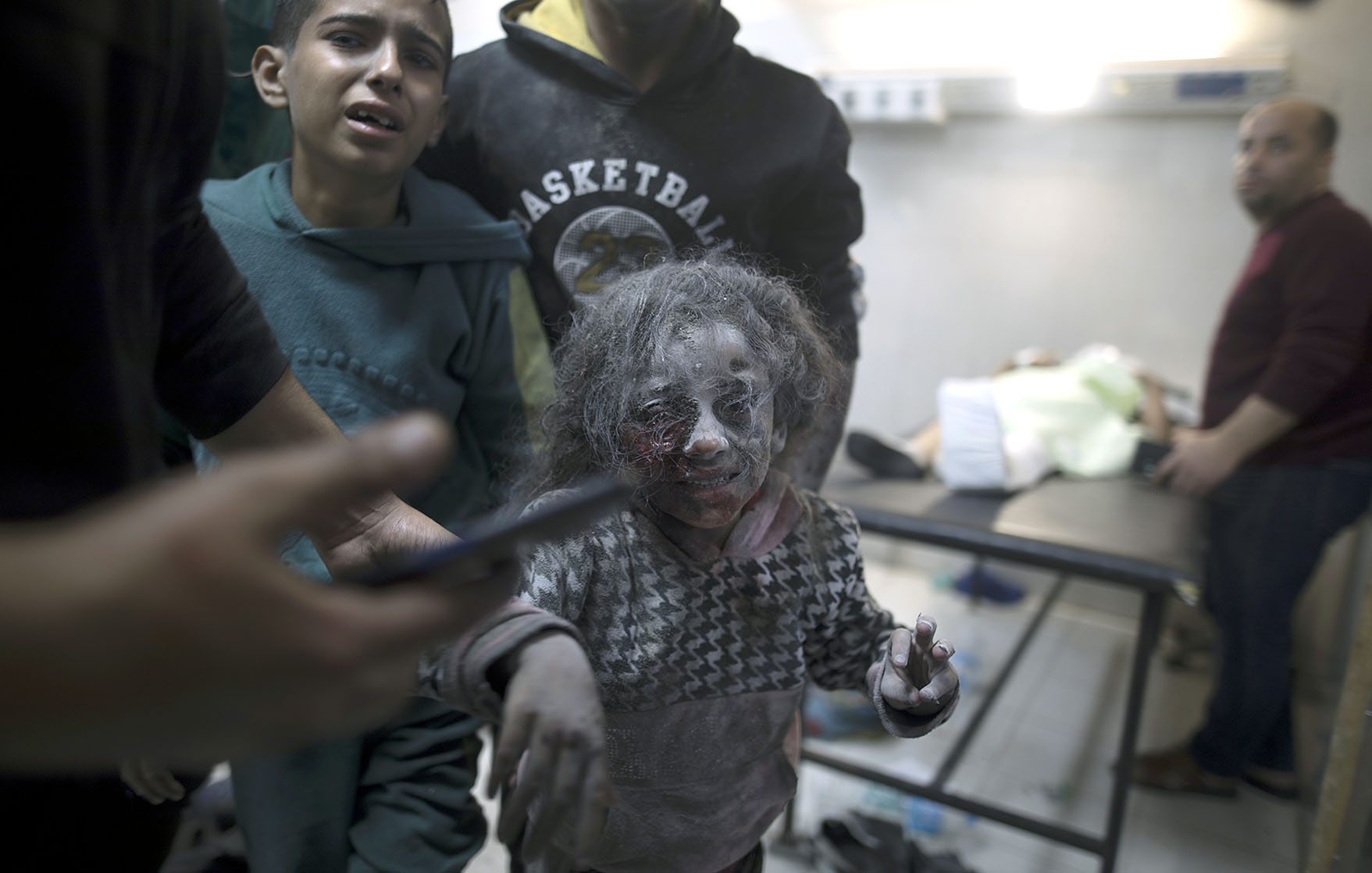 Wounded child, Gaza