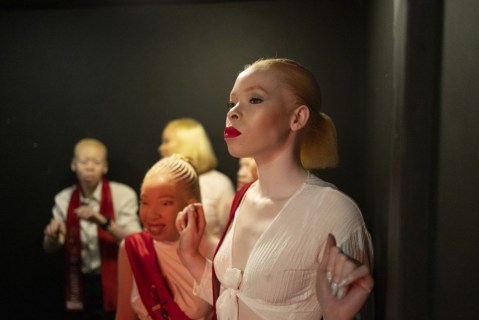 South Africa Mr and Mrs Albinism Pageant in Johannesburg