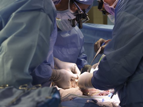 The first pig kidney has been transplanted into a living person. But we’re still a long way from solving organ shortages