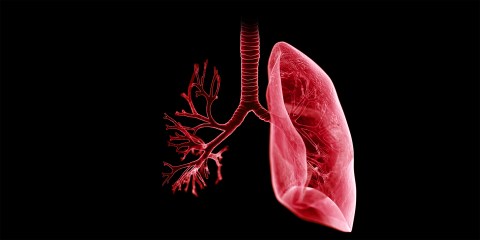 The South African lung – can it breathe through the surge?