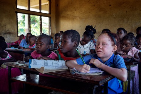 Discrimination and barriers to education for persons with albinism in Tete Province, Mozambique