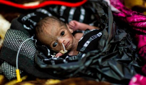 Somalia: The baby in a plastic bag