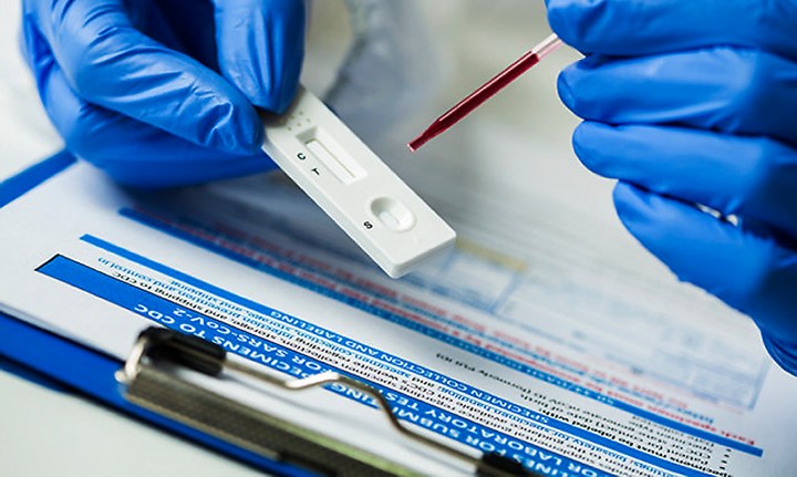 The False Hope of Antibody Testing