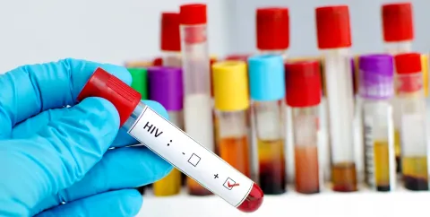 HIV death rate in SA men much higher than in women