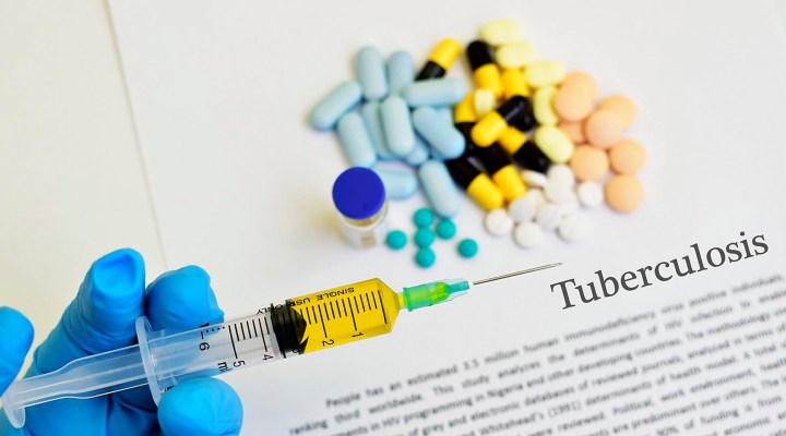 It’s vital to prioritise TB preventive therapy for almost a million South Africans – right now