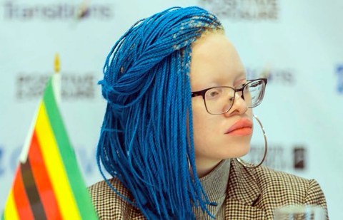 Challenging prejudice and normalising People With Albinism is the missing key, says activist