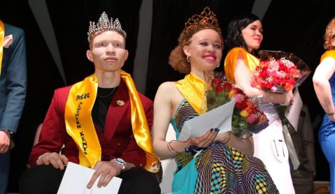 Kenya hosts the world’s first albino beauty pageant