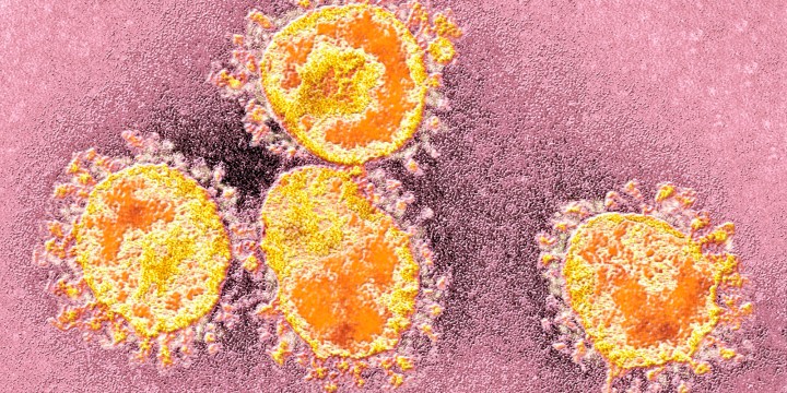 As first Coronavirus case confirmed, South Africa told to keep calm