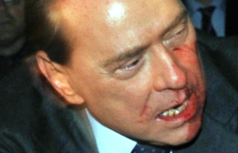 In latest dust-up, Berlusconi gets broken nose/teeth, not black eye this time
